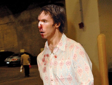 Steve Nash Still Bleeding