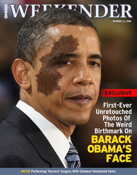 First-Ever Untouched Photos Of The Weird Birthmark On Barack Obama's Face