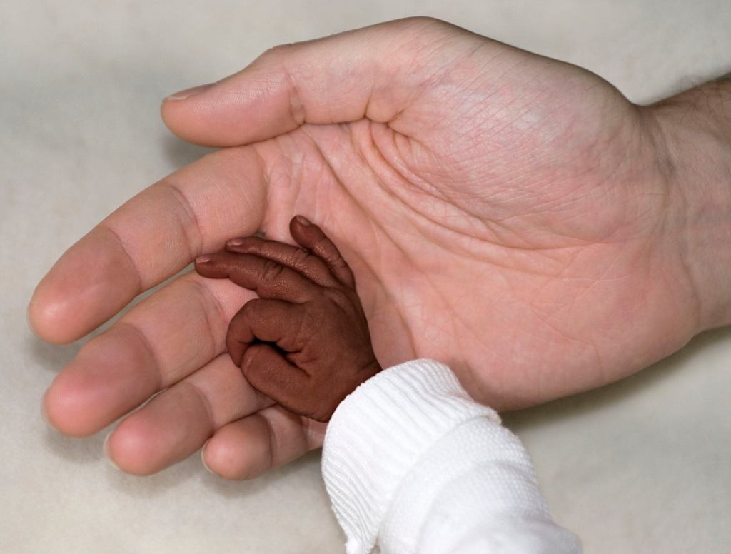 AIDS Baby Lays Tiny Hand In Palm Of 'Onion' Reporter