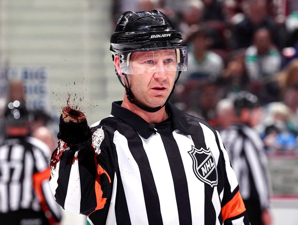 Hockey Referee Comes Away From Faceoff Without Hand