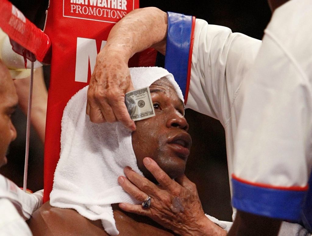 Trainer Applies Fresh $100 Bill To Floyd Mayweather’s Bleeding Eyelid