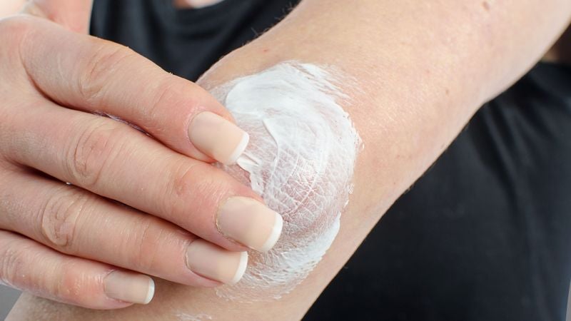 Woman Conducting Ongoing Scientific Experiment On Own Skin