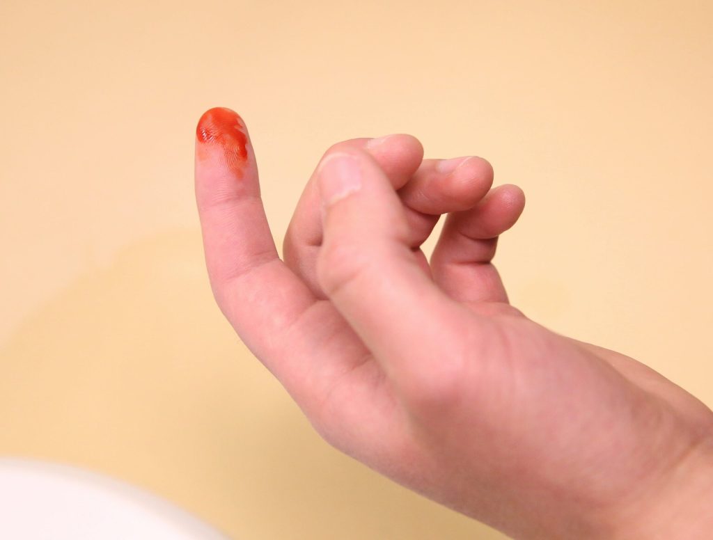 Blood-Covered Finger Confirms Nose, In Fact, Bleeding