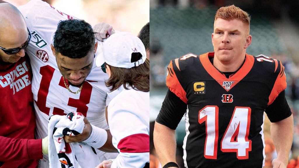 Bengals Assure Injury Prone Tua Tagovailoa He Can Have Any Of Andy Dalton's Organs