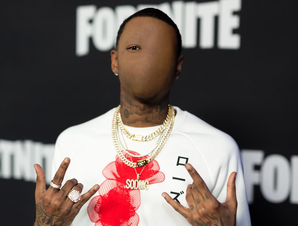 Soulja Boy Shocks Fans After Having Face Tattoo Removed