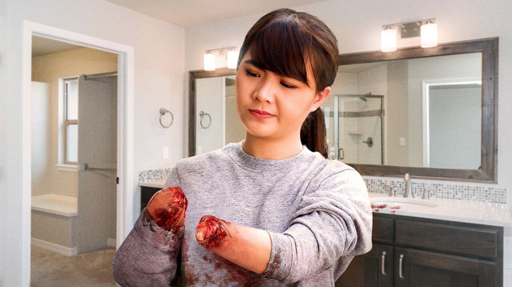 Woman’s Hands Become Bloody Nubs Of Raw Flesh After Forgetting Nightly Moisturizing Routine