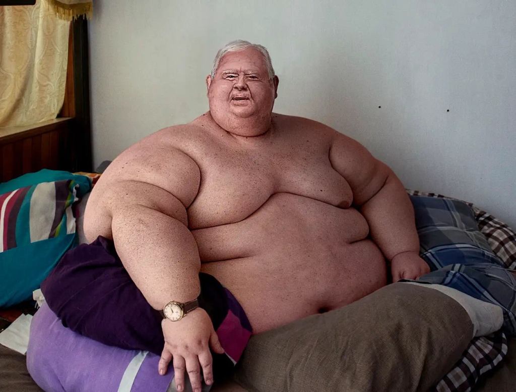 Jimmy Carter Becomes World’s Heaviest Man At 850 Pounds