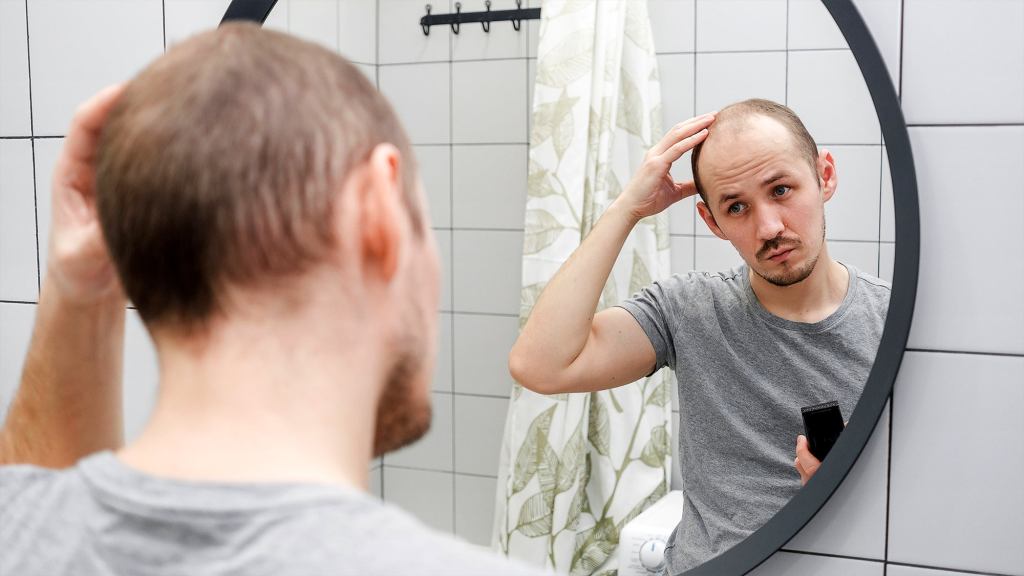 Losing All Of His Hair And Becoming Impotent Clear Sign From Man’s Body That He Should Stay In And Play More Video Games